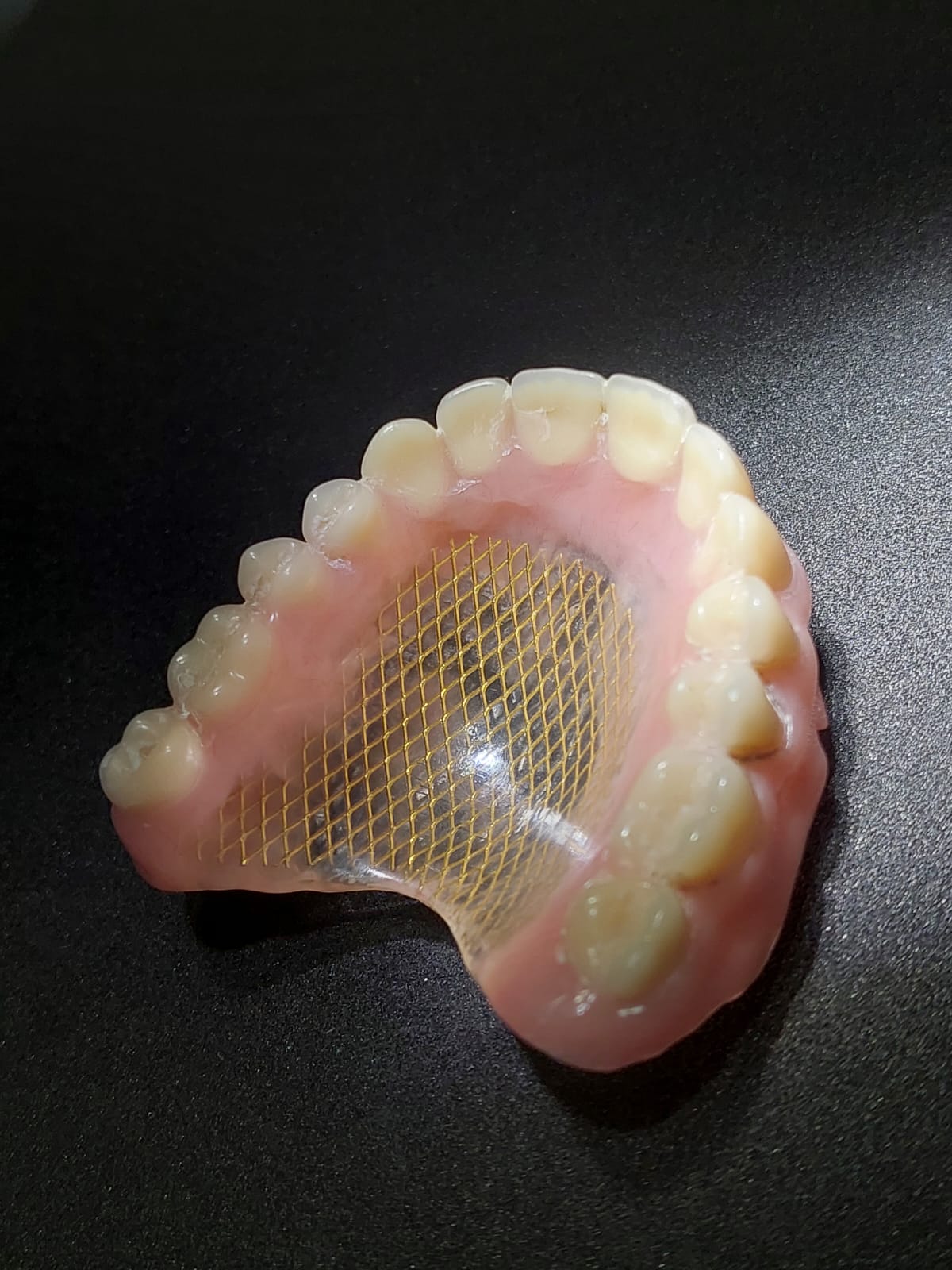 Equipo dental